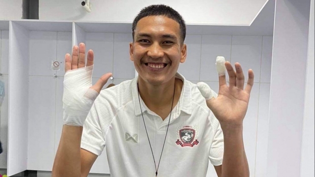 ยังยิ้มได้!สุพรรณเผยเย็บ5เข็มที่คุ้มค่าหลังชนป้ายโฆษณาเกมเจ๊าบุรีรัมย์